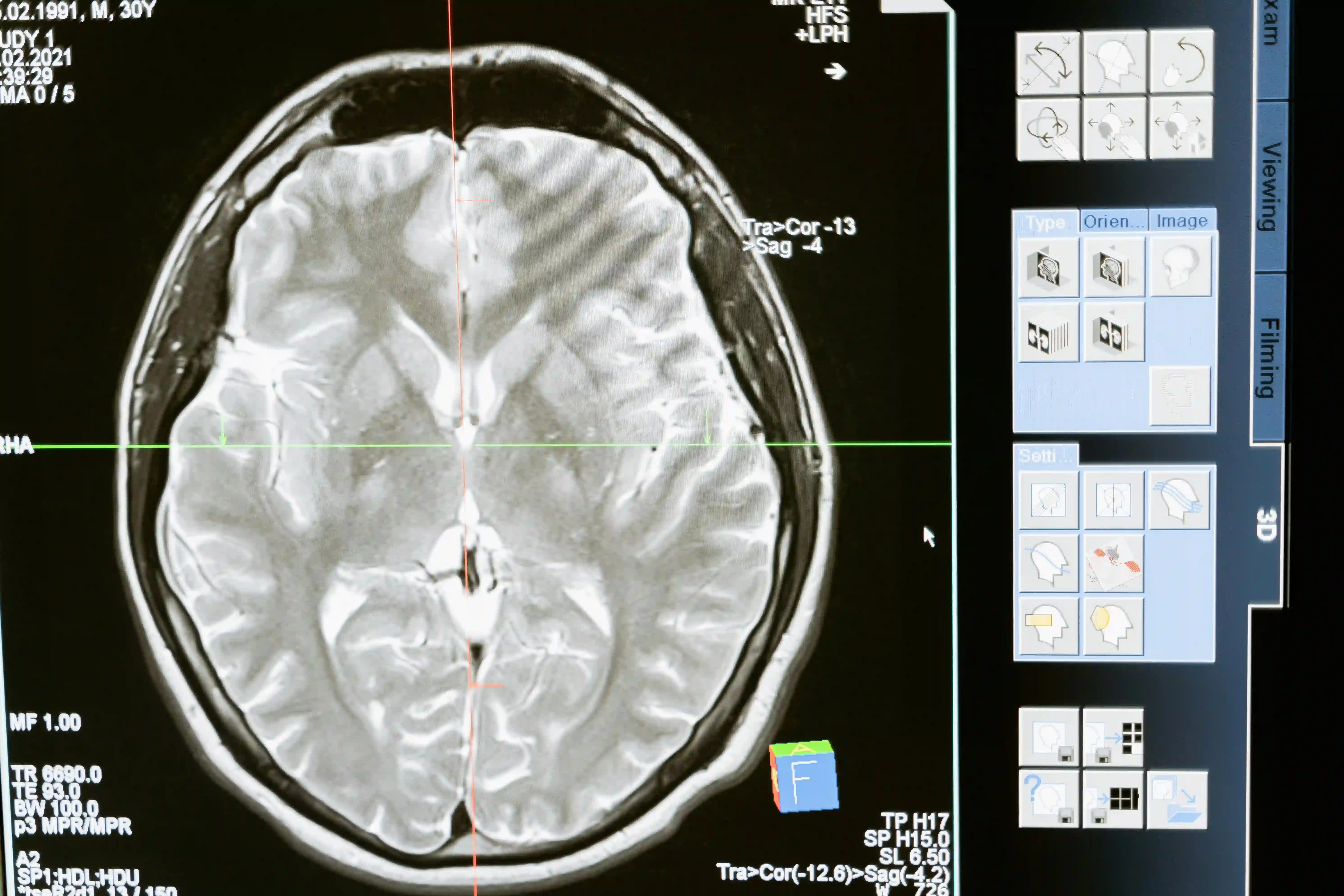 Innovations-in-Neurological-Surgery